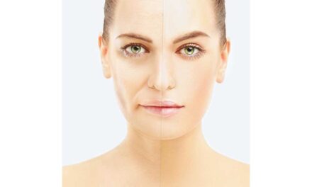 Fiatalos bőr műtét nélkül? Igen, lehetséges!