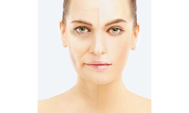 Fiatalos bőr műtét nélkül? Igen, lehetséges!