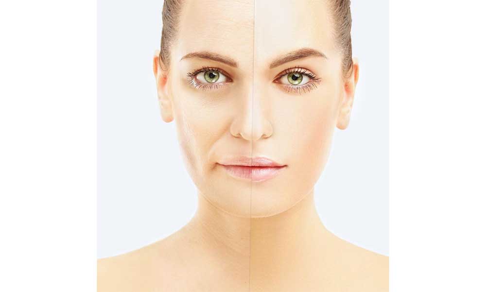 Fiatalos bőr műtét nélkül? Igen, lehetséges!