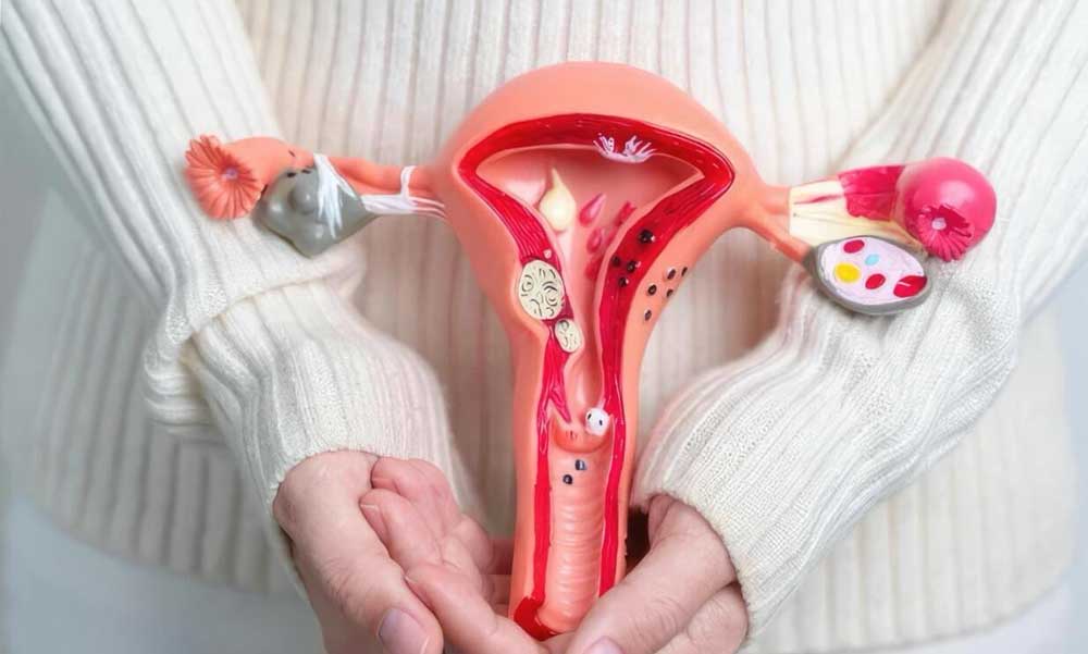 A petefészek ciszták érzelmi háttere és a többrekeszes ciszták jelentősége